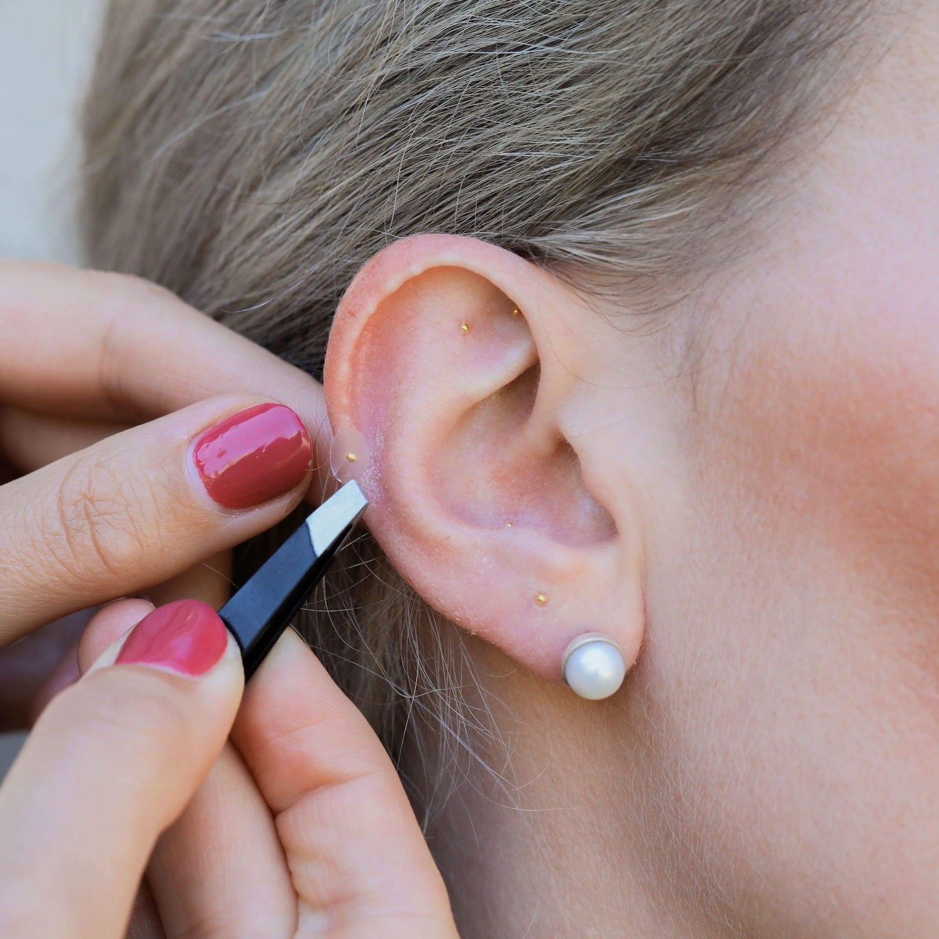 Goldene Ear Seeds werden mit transparentem Pflastertape am Ohr angebracht, optional mit Hilfe einer Pinzette.